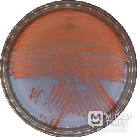 신종 비브리오 VRS2 균주를 배양한 사진(적색의 프로디지오신을 생성함)